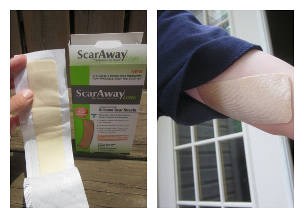 ScarAway Review and Giveaway | Family Focus Blog
